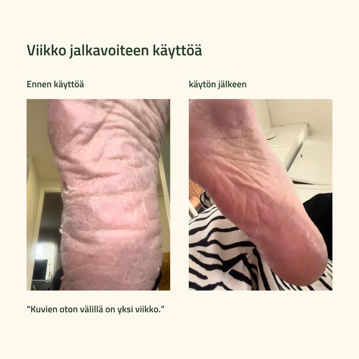 Pihkapaketti jaloille